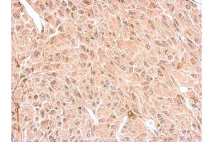 IHC-P Image CNP antibody detects CNP protein at cytosol on U87 xenograft by immunohistochemical analysis. (Cnpase anticorps)