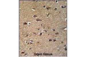Formalin-fixed and paraffin-embedded human brain reacted with GCAT Antibody (Center), which was peroxidase-conjugated to the secondary antibody, followed by DAB staining.