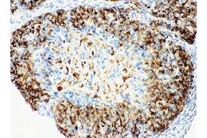 IHC-P: HSD17B1 antibody testing of rat ovary tissue