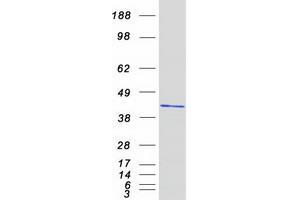Validation with Western Blot
