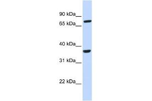 WB Suggested Anti-CCRL2 Antibody Titration:  0. (CCRL2 anticorps  (N-Term))