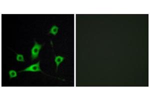 Immunofluorescence analysis of LOVO cells, using CRBP III antibody. (Retinol Binding Protein 5 anticorps  (N-Term))