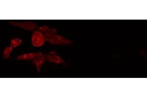 ABIN6274081 staining COLO205 cells by IF/ICC.