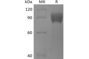 Western Blotting (WB) image for Trophoblast Glycoprotein (TPBG) protein (mFc Tag) (ABIN7319827) (TPBG Protein (mFc Tag))