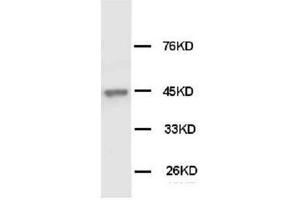 Western Blotting (WB) image for anti-Keratin 18 (KRT18) antibody (ABIN1106917) (Cytokeratin 18 anticorps)