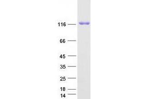 Validation with Western Blot
