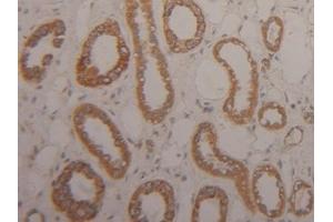 Detection of Arg2 in Human Kidney Tissue using Polyclonal Antibody to Arginase II (Arg2)