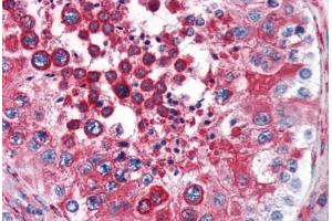 Human Testis (formalin-fixed, paraffin-embedded) stained with RTN4 antibody ABIN343914 at 3 ug/ml followed by biotinylated goat anti-rabbit IgG secondary antibody ABIN481713, alkaline phosphatase-streptavidin and chromogen. (Reticulon 4 anticorps  (N-Term))