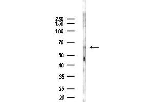 Western blot analysis of lysates from Rat brain, using L Antibody at 1/1000 dilution.