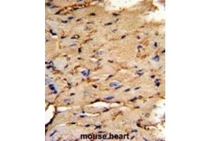 Immunohistochemistry (IHC) image for anti-phosphoprotein Enriched in Astrocytes 15 (PEA15) antibody (ABIN3003786) (PEA15 anticorps)