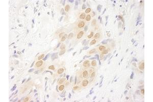 anti-DOT1-Like, Histone H3 Methyltransferase (S. Cerevisiae) (DOT1L) (AA 1000-1050) antibody