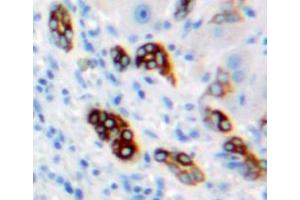 Used in DAB staining on fromalin fixed paraffin-embedded liver tissue (CA9 anticorps  (AA 59-414))