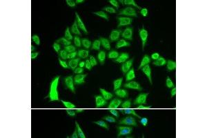 Immunofluorescence analysis of A549 cells using IREB2 Polyclonal Antibody (IREB2 anticorps)