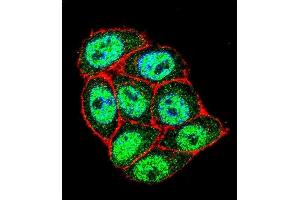 Confocal immunofluorescent analysis of p16INK4a Antibody (C-term ) (ABIN1981278 and ABIN2845115) with Hela cell followed by Alexa Fluor 488-conjugated goat anti-rabbit lgG (green).