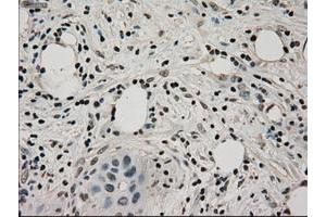 Image no. 3 for anti-Lactate Dehydrogenase A (LDHA) antibody (ABIN1499114)