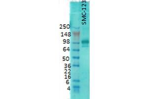 Western Blot analysis of Rat brain membrane lysate showing detection of PSD95 protein using Mouse Anti-PSD95 Monoclonal Antibody, Clone 7E3 .