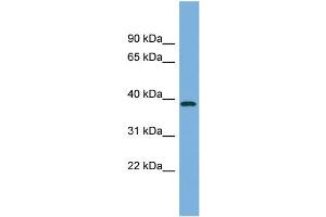 WB Suggested Anti-FBP2 Antibody Titration:  0. (FBP2 anticorps  (Middle Region))