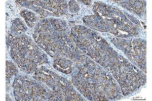 IHC analysis of Poliovirus Receptor/PVR using anti-Poliovirus Receptor/PVR antibody (ABIN7601072). (Poliovirus Receptor anticorps  (AA 28-331))