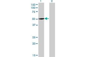 Western Blot analysis of ZNF213 expression in transfected 293T cell line by ZNF213 monoclonal antibody (M01), clone 5D7.