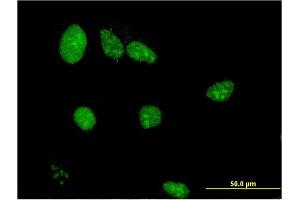 Immunofluorescence of monoclonal antibody to LIMD1 on HeLa cell.