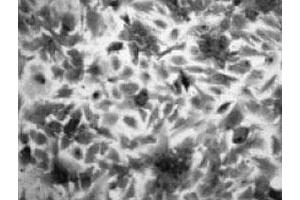 Imunohistochemical analysis of rat brain astrocyte, using Slc22a3 polyclonal antibody  .