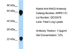 Western Blotting (WB) image for anti-Recombination Activating Gene 2 (RAG2) (C-Term) antibody (ABIN2788687) (RAG2 anticorps  (C-Term))