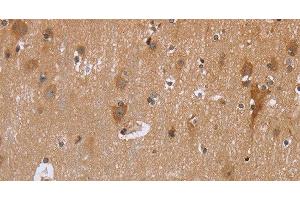 Immunohistochemistry of paraffin-embedded Human brain using GABPB2 Polyclonal Antibody at dilution of 1:30