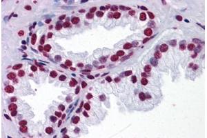 Human Prostate: Formalin-Fixed, Paraffin-Embedded (FFPE)