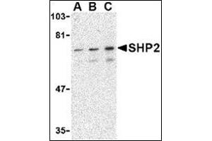 Western blot analysis of SHP2 in mouse skeletal muscle tissue lysate with this product at (A) 0. (PTPN11 anticorps  (C-Term))