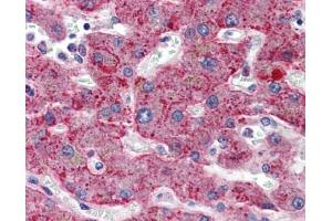 Immunohistochemistry (IHC) image for anti-Serpin Peptidase Inhibitor, Clade G (C1 Inhibitor), Member 1 (SERPING1) (AA 1-501) antibody (ABIN2471356)