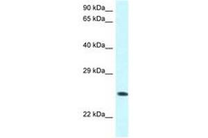 Image no. 1 for anti-WW Domain Containing Oxidoreductase (WWOX) (AA 95-144) antibody (ABIN6747534)