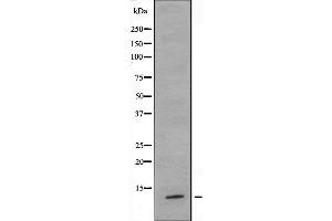 Western blot analysis of extracts from HeLa cells, using TUSC2 antibody. (TUSC2 anticorps  (Internal Region))