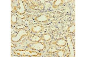 Immunohistochemistry of paraffin-embedded human kidney tissue using ABIN7170187 at dilution of 1:100 (SLC25A35 anticorps  (AA 120-168))