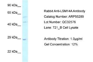 WB Suggested Anti-LSM14A Antibody Titration: 0. (LSM14A anticorps  (C-Term))