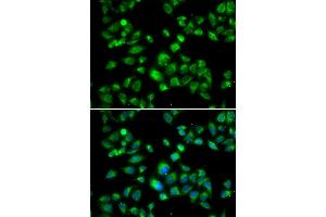 Immunofluorescence analysis of U2OS cells using MBTPS1 antibody. (MBTPS1 anticorps)