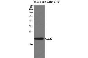 Western Blotting (WB) image for anti-Cytochrome C Oxidase Subunit IV Isoform 2 (Lung) (COX4I2) (Internal Region) antibody (ABIN3179977) (COX4I2 anticorps  (Internal Region))