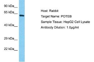Host: Rabbit Target Name: POTEB Sample Type: HepG2 Whole Cell lysates Antibody Dilution: 1.