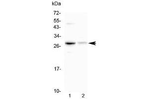 Western blot testing of 1) mouse HEPA1-6 and 2) rat kidney lysate with Oncostatin M antibody at 0. (Oncostatin M anticorps)