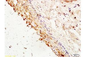 Formalin-fixed and paraffin embedded rat ovary tissue labeled with Anti-Cyclin G Polyclonal Antibody, Unconjugated  at 1:200 followed by conjugation to the secondary antibody and DAB staining