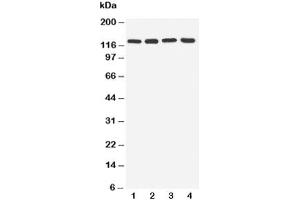 Western blot testing of TLR7 antibody and Lane 1:  rat spleen