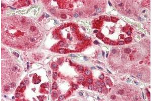 Human Kidney: Formalin-Fixed, Paraffin-Embedded (FFPE)