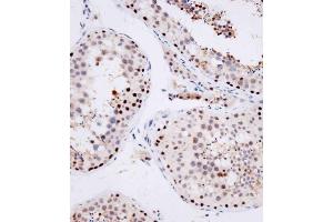 Immunohistochemical analysis of (ABIN1539554 and ABIN2849696) on paraffin-embedded human testis tissue was performed on the Leica®BOND RXm. (OTUD7A anticorps  (N-Term))
