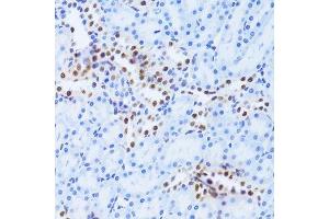 Immunohistochemistry of paraffin-embedded rat kidney using ANP32A Antibody.