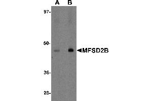 Western blot analysis of MFSD2B in rat lung tissue lysate with MFSD2B antibody at (A) 1 and (B) 2 µg/mL.