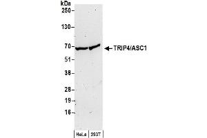 Western Blotting (WB) image for anti-Thyroid Hormone Receptor Interactor 4 (TRIP4) (AA 75-125) antibody (ABIN7449573)