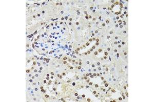 Immunohistochemistry of paraffin-embedded rat kidney using CDX2 antibody (ABIN5970799) at dilution of 1/100 (40x lens). (CDX2 anticorps)