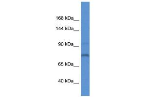 WB Suggested Anti-Itih1 Antibody   Titration: 1. (ITIH1 anticorps  (Middle Region))