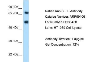 WB Suggested Anti-SELE Antibody Titration: 0. (Selectin E/CD62e anticorps  (N-Term))