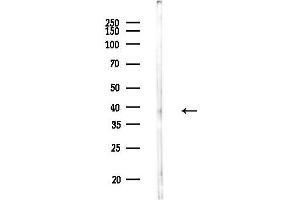 Western blot analysis of lysates from F10-LUC cells, using PDC Antibody at 1/1000 dilution.