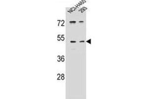 Western Blotting (WB) image for anti-Protease, Serine, 55 (PRSS55) antibody (ABIN2996346) (PRSS55 anticorps)